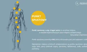 Anatomical illustration showing a human body with yellow dots indicating punkty spustowe. These sensitive spots can cause pain when pressed.