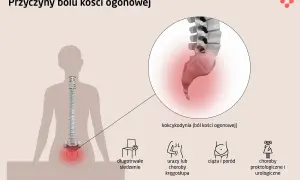 Ból kości ogonowej (kokcygodynia) może być spowodowany długotrwałym siedzeniem, urazami, ciążą lub chorobami. Na ilustracji zaznaczono kość krzyżową.