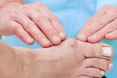Jakie ćwiczenia po operacji palucha sztywnego pomogą w rehabilitacji?
