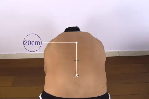 Pomiar zakresu ruchu kręgosłupa, znany jako objaw Schobera, pokazuje 20 cm rozciągnięcia.