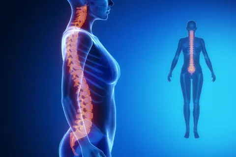 Anatomia kręgosłupa z widoczną lordozą. Kręgosłup w kolorze pomarańczowym na tle niebieskiej sylwetki kobiety.