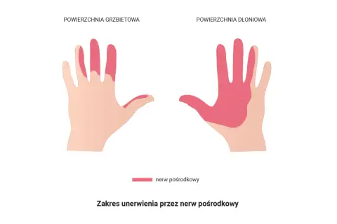 Obszar unerwienia przez nerw pośrodkowy na grzbietowej i dłoniowej stronie dłoni. Może to być związane z drganiem mięśni.