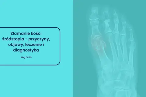 Rentgen stopy ukazujący złamanie kości śródstopia. Tekst informuje o przyczynach, objawach, leczeniu i diagnostyce.