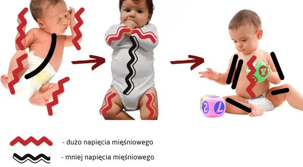 Od noworodka z wzmożonym napięciem mięśniowym, przez niemowlę w body, do dziecka bawiącego się klockami. Grafika pokazuje redukcję napięcia.