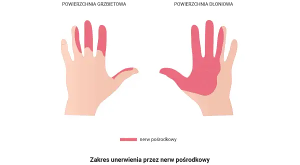 Obszar unerwienia przez nerw pośrodkowy na grzbietowej i dłoniowej stronie dłoni. Może to być związane z drganiem mięśni.