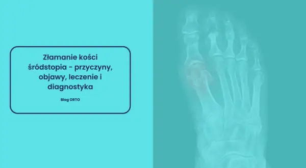 Rentgen stopy ukazujący złamanie kości śródstopia. Tekst informuje o przyczynach, objawach, leczeniu i diagnostyce.