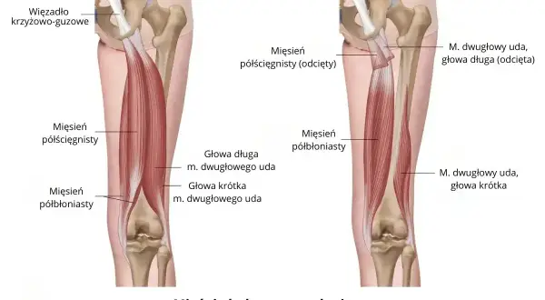 Anatomia mięśnia dwugłowego uda, pokazująca jego głowy długą i krótką, oraz mięsień półścięgnisty i półbłoniasty.