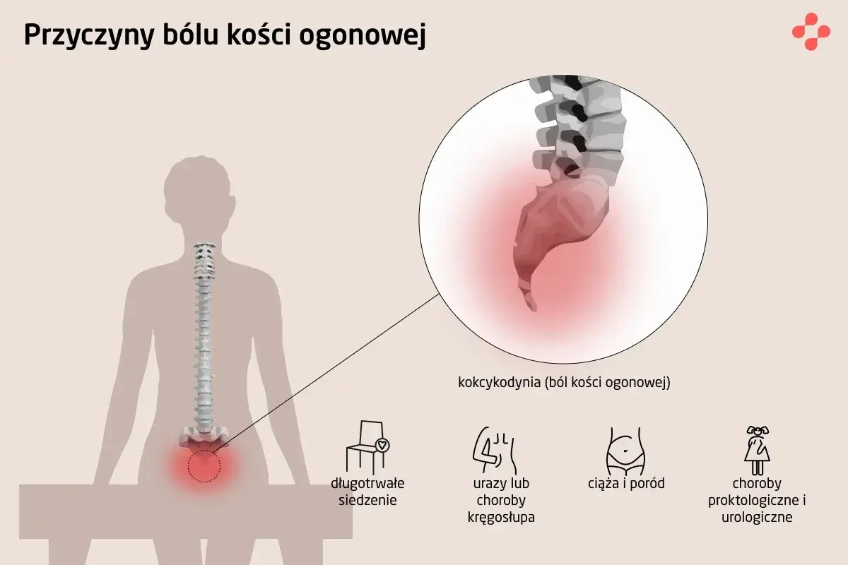 Ból kości ogonowej (kokcygodynia) może być spowodowany długotrwałym siedzeniem, urazami, ciążą lub chorobami. Na ilustracji zaznaczono kość krzyżową.