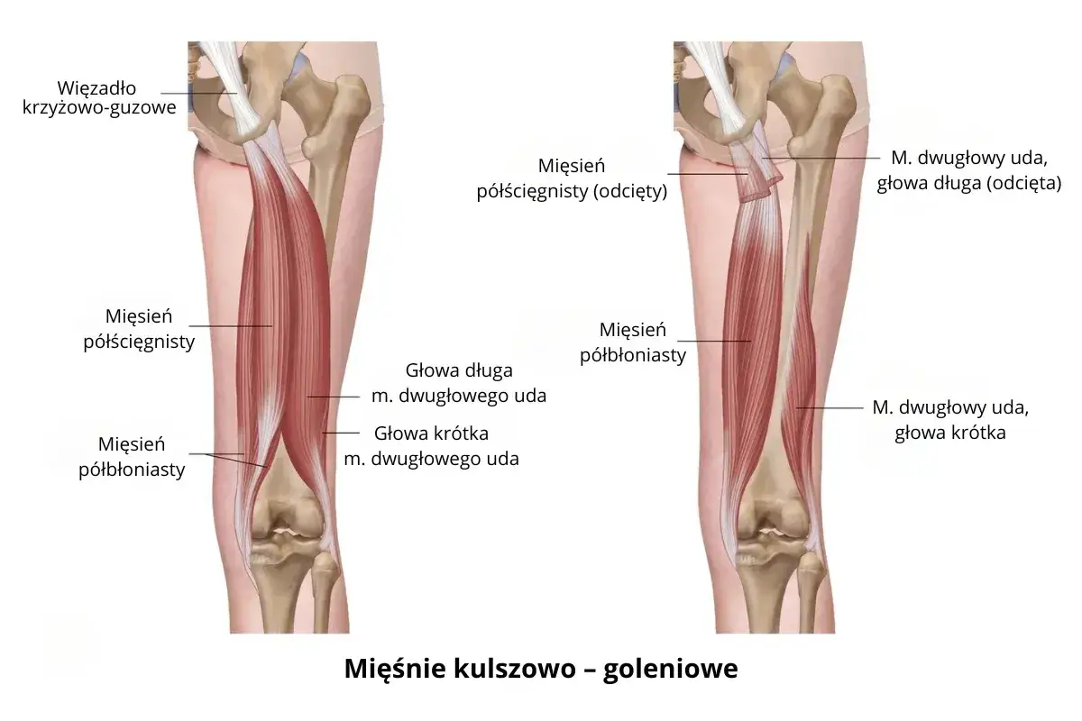 Anatomia uda: mięsień półścięgnisty i półbłoniasty, z zaznaczonym więzadłem krzyżowo-guzowym.