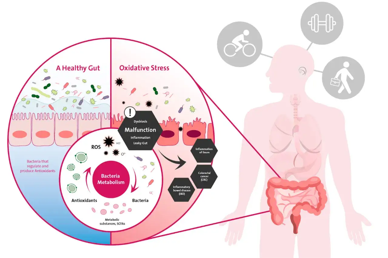 Ilustracja pokazuje, jak zdrowie jelit wpływa na metabolizm. Dysbioza i stres oksydacyjny prowadzą do stanów zapalnych, a kuracja jelitowo metaboliczna przywraca równowagę.