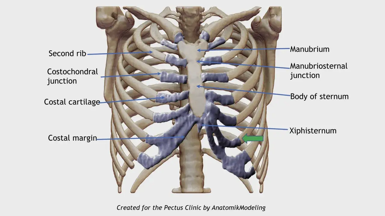 Anatomia klatki piersiowej z zaznaczonymi elementami: mostek, żebra, chrząstki. Widoczna szewska klatka piersiowa, czyli budowa kostna klatki.
