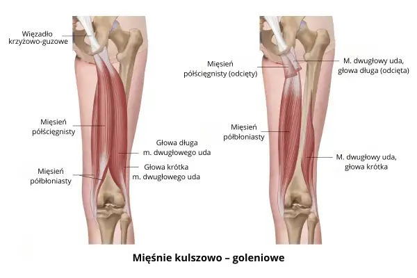 Anatomia uda: mięsień półścięgnisty i półbłoniasty, z zaznaczonym więzadłem krzyżowo-guzowym.