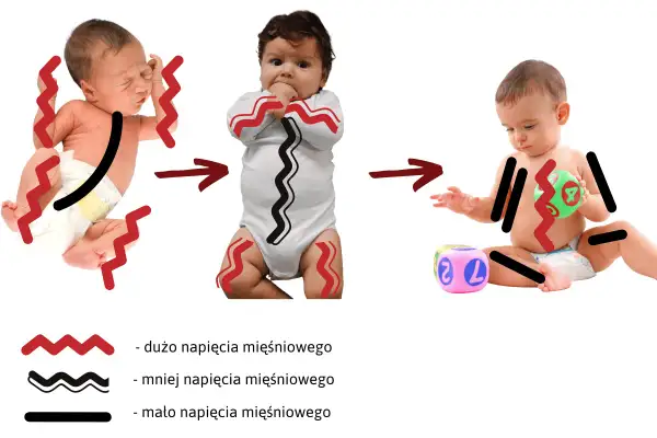 Od noworodka z wzmożonym napięciem mięśniowym, przez niemowlę w body, do dziecka bawiącego się klockami. Grafika pokazuje redukcję napięcia.