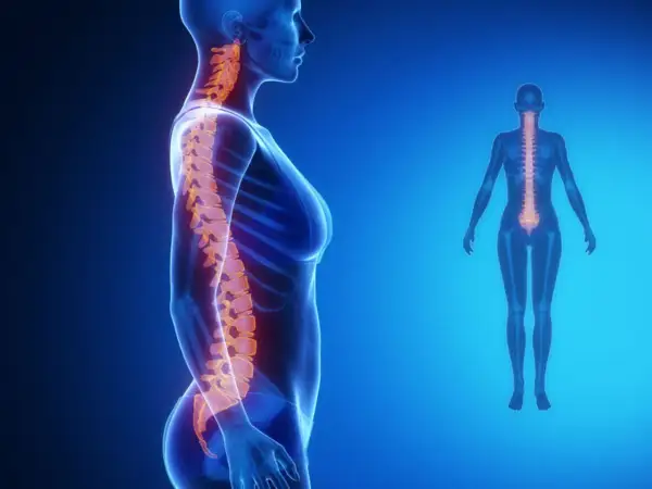 Anatomia kręgosłupa z widoczną lordozą. Kręgosłup w kolorze pomarańczowym na tle niebieskiej sylwetki kobiety.