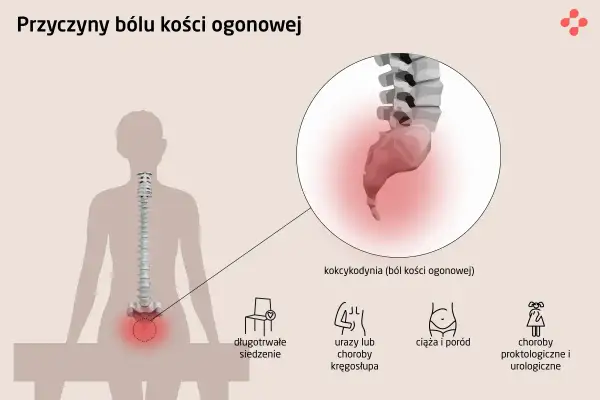 Ból kości ogonowej (kokcygodynia) może być spowodowany długotrwałym siedzeniem, urazami, ciążą lub chorobami. Na ilustracji zaznaczono kość krzyżową.