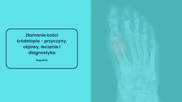 Rentgen stopy ukazujący złamanie kości śródstopia. Tekst informuje o przyczynach, objawach, leczeniu i diagnostyce.